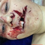 Woman died after sustaining fatal intraoral gunshot wound