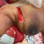 Sonia LaBeach Dillion