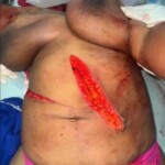 Sonia LaBeach Dillion