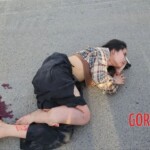 Young Cambodian woman lost her leg in collision with car