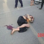 Young Cambodian woman lost her leg in collision with car