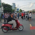 Young Cambodian woman lost her leg in collision with car