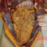 Chinese woman found dead in park