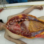 Chinese woman found dead in park