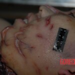 Female victim of machete attack