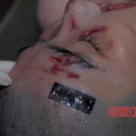 Female victim of machete attack