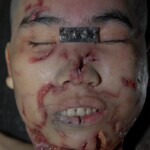 Female victim of machete attack