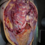 Female victim of machete attack