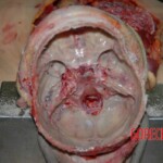 Female victim of machete attack