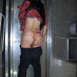 Female victim of machete attack