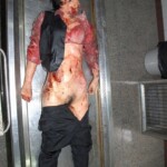 Female victim of machete attack