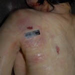 Female victim of machete attack