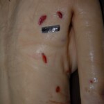 Female victim of machete attack