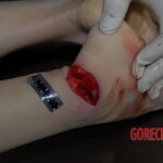 Female victim of machete attack