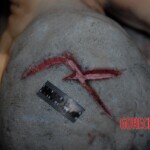 Female victim of machete attack