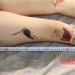 Initial examination of dead Chinese woman