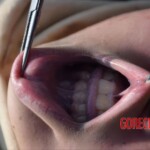 Initial examination of drowned Chinese teenage girl