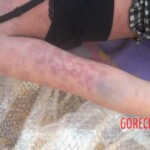 Initial examination of drowned Chinese woman