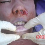 Initial examination of drowned Chinese woman