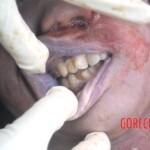 Initial examination of drowned Chinese woman