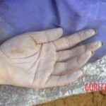 Initial examination of drowned Chinese woman