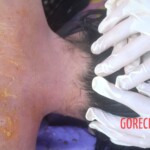 Initial examination of drowned Chinese woman