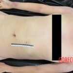 Initial examination of raped teenager