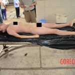 Initial examination of raped teenager