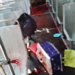 Mentally ill man slit his throat with box cutter