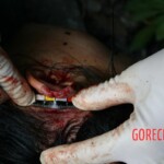 Raped and thrown off cliff