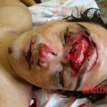 Suicidal jumper after impact from roof of skyscraper