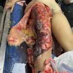 Venezuelan woman succumbed to injuries she suffered in car crash