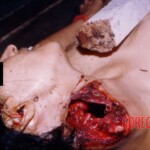 Woman impaled by wooden slat