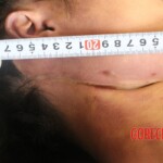 Young Chinese woman found hanged in forest