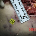 Young Italian woman killed by pack of shepherd dogs