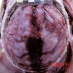 Young woman found in advanced stage of decomposition