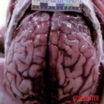 Young woman found in advanced stage of decomposition