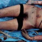 Young woman found in advanced stage of decomposition