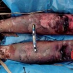 Young woman found in advanced stage of decomposition