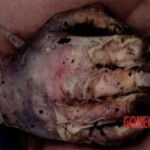 Young woman found in advanced stage of decomposition