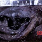 Young woman found in advanced stage of decomposition