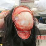 Examination and autopsy of Chinese woman
