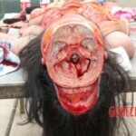 Examination and autopsy of Chinese woman