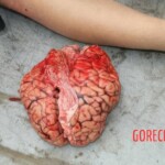 Examination and autopsy of Chinese woman