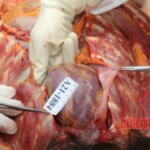 Examination and autopsy of Chinese woman
