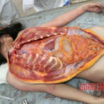Examination and autopsy of Chinese woman