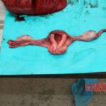 Examination and autopsy of Chinese woman