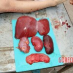 Examination and autopsy of Chinese woman