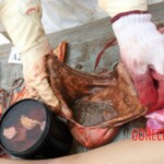 Examination and autopsy of Chinese woman