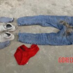 Examination and autopsy of Chinese woman
